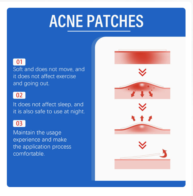 Acne Patches for discreet targeted blemish care and everyday skincare